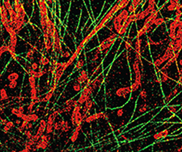 Development of nano-tools for quantitative bio-imaging