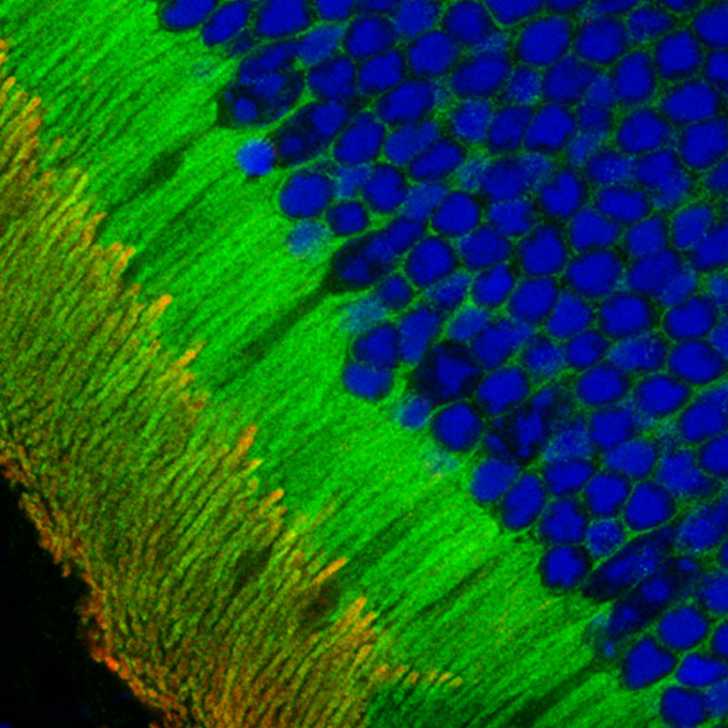 Dissecting protein trafficking in retinal neurodegeneration