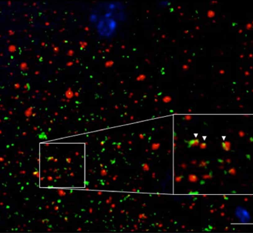 Combining Array Tomography (AT) and STED for studying Alzheimer’s diseases