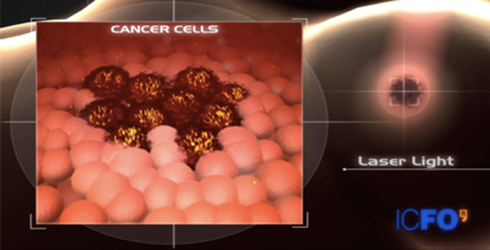 Plasmon-based targeted Hypertermia