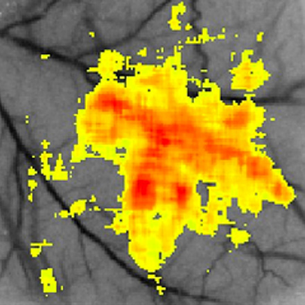 Medical Optics