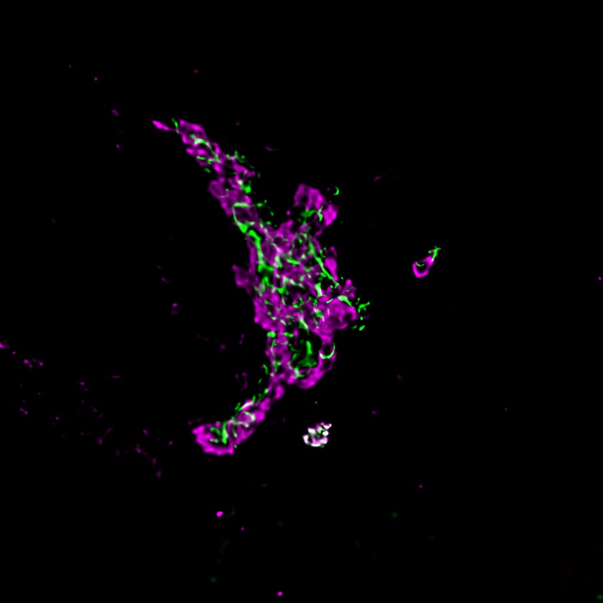 Golgi Membrane Morphology and Dynamics